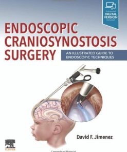 Endoscopic Craniosynostosis Surgery: An Illustrated Guide to Endoscopic Techniques (Original PDF from Publisher)