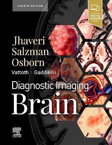 Diagnostic Imaging: Brain, 4th Edition (PDF) Diagnostic Imaging: Brain, 4th Edition (PDF)
