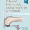 Calipered Kinematically aligned Total Knee Arthroplasty: Theory, Surgical Techniques and Perspectives (PDF)