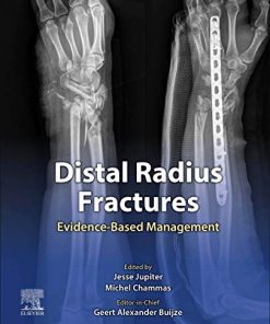 Distal Radius Fractures: Evidence-Based Management (True PDF+ToC+Index+Videos)