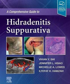 A Comprehensive Guide to Hidradenitis Suppurativa (PDF)