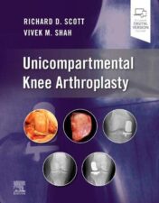 Unicompartmental Knee Arthroplasty 2022 Original PDF