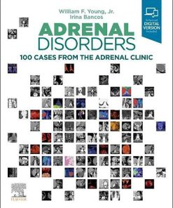 Adrenal Disorders: 100 Cases from the Adrenal Clinic (PDF)