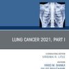 Lung Cancer 2021, Part 1, An Issue of Thoracic Surgery Clinics (PDF)