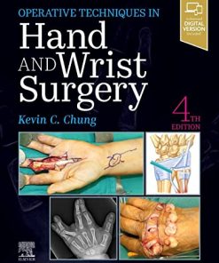 Operative Techniques: Hand and Wrist Surgery, 4th Edition (Videos, Well-organized)