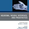 Neuroma, Neural interface, and Prosthetics, An Issue of Hand Clinics (PDF)