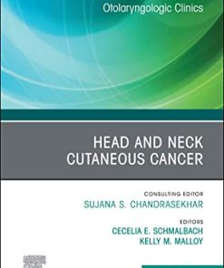 Head and Neck Cutaneous Cancer, An Issue of Otolaryngologic Clinics of North America (PDF)