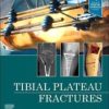 Tibial Plateau Fractures 2022 EPUB + Converted PDF Tibial Plateau Fractures 2022 EPUB + Converted PDF