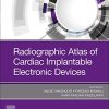 Radiographic Atlas of Cardiac Implantable Electronic Devices (PDF)