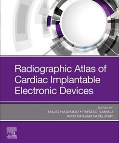 Radiographic Atlas of Cardiac Implantable Electronic Devices (PDF)