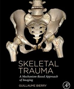 Skeletal Trauma: A Mechanism-Based Approach of Imaging (PDF)