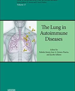 The Lung in Autoimmune Diseases (Volume 17) (Handbook of Systemic Autoimmune Diseases, Volume 17) (PDF)