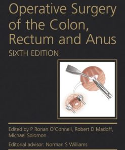 Operative Surgery of the Colon, Rectum and Anus, 6th Edition (PDF)