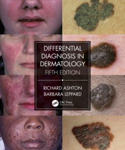 Differential Diagnosis in Dermatology, 5th Edition (PDF)