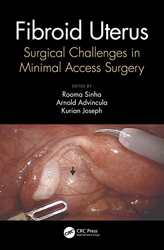 Fibroid Uterus: Surgical Challenges in Minimal Access Surgery (PDF) Fibroid Uterus: Surgical Challenges in Minimal Access Surgery (PDF)