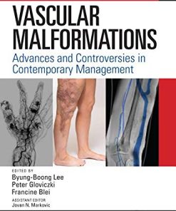 Vascular Malformations: Advances and Controversies in Contemporary Management (PDF)