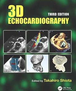 3D Echocardiography, 3rd edition (PDF)