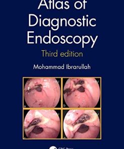 Atlas of Diagnostic Endoscopy, 3E (PDF)