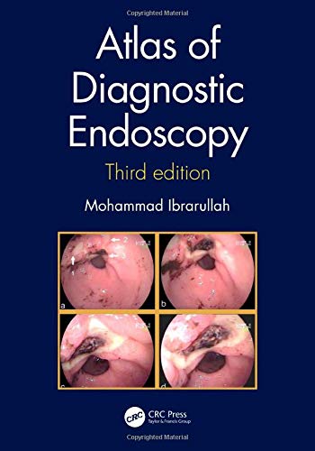 Atlas of Diagnostic Endoscopy, 3E (PDF) Atlas of Diagnostic Endoscopy, 3E (PDF)