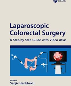 Laparoscopic Colorectal Surgery: A Step by Step Guide with Video Atlas (PDF)