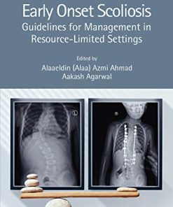 Early Onset Scoliosis: Guidelines for Management in Resource-Limited Settings (PDF)