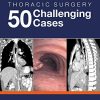 Thoracic Surgery: 50 Challenging cases (PDF) Thoracic Surgery: 50 Challenging cases (PDF)