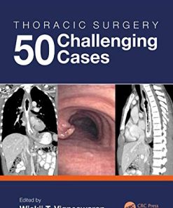 Thoracic Surgery: 50 Challenging cases (PDF)