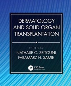 Dermatology and Solid Organ Transplantation (Series in Dermatological Treatment) (PDF)