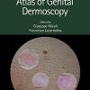 Atlas of Genital Dermoscopy (PDF)