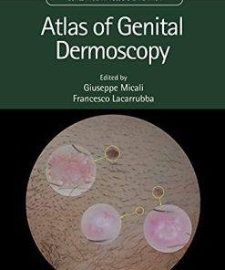 Atlas of Genital Dermoscopy (PDF)