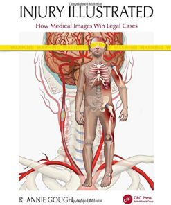 Injury Illustrated: How Medical Images Win Legal Cases (PDF)