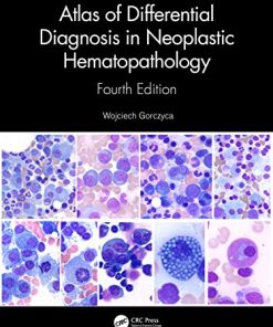 Atlas of Differential Diagnosis in Neoplastic Hematopathology, 4th Edition (PDF)