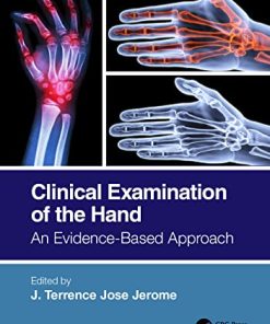 Clinical Examination of the Hand: An Evidence-Based Approach (PDF)