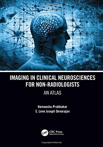 Imaging in Clinical Neurosciences for Non-radiologists: An Atlas (PDF) Imaging in Clinical Neurosciences for Non-radiologists: An Atlas (PDF)
