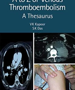 A to Z of Venous Thromboembolism: A Thesaurus (PDF)