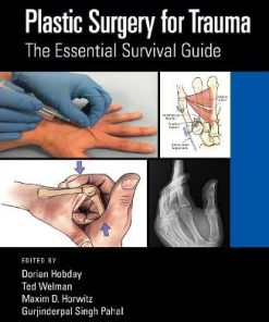 Plastic Surgery for Trauma: The Essential Survival Guide (PDF)