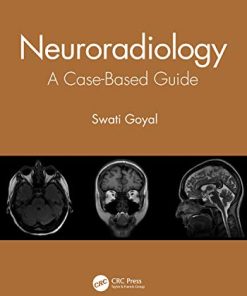 Neuroradiology: A Case-Based Guide (PDF)