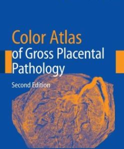 Color Atlas of Gross Placental Pathology / Edition 2 (PDF)