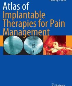 Atlas of Implantable Therapies for Pain Management (PDF)