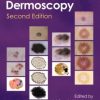 An Atlas of Dermoscopy, 2nd Edition