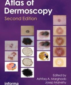 An Atlas of Dermoscopy, 2nd Edition