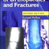 Pocketbook of Orthopaedics and Fractures, 2nd Edition