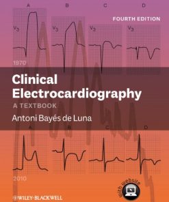 Clinical Electrocardiography: A Textbook, 4th Edition (PDF)