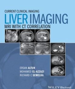 Liver Imaging: MRI with CT Correlation