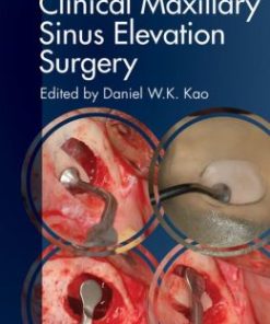 Clinical Maxillary Sinus Elevation Surgery