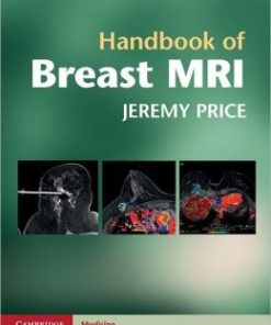 Handbook of Breast MRI