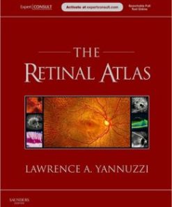 The Retinal Atlas (PDF)