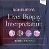 Scheuer’s Liver Biopsy Interpretation, 10th Edition (PDF)