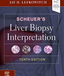 Scheuer’s Liver Biopsy Interpretation, 10th Edition (PDF)