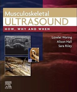 Musculoskeletal Ultrasound: How, Why and When (PDF)